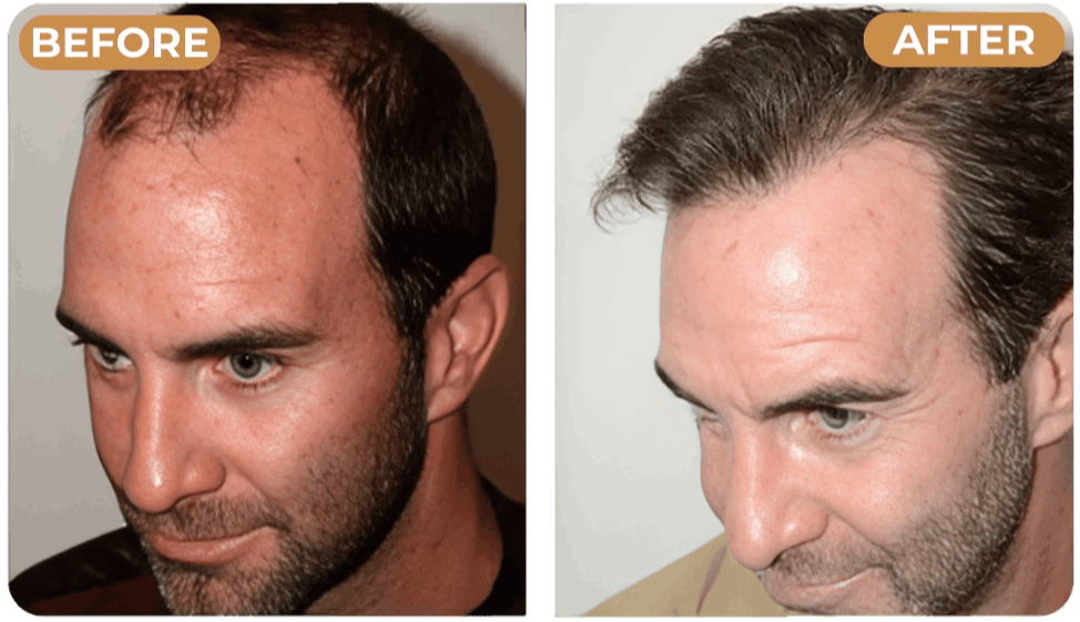 Spartan Root Activator Shampoo