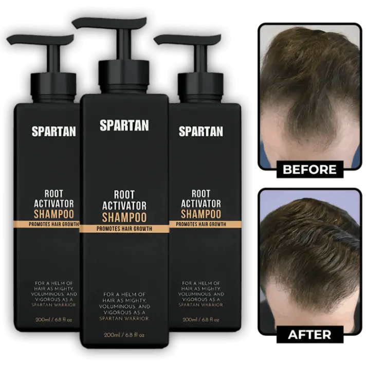 Buy Now Spartan Root Activator Shampoo